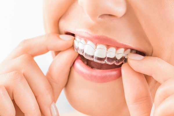 What Cosmetic Orthodontics Can Do For Your Smile
